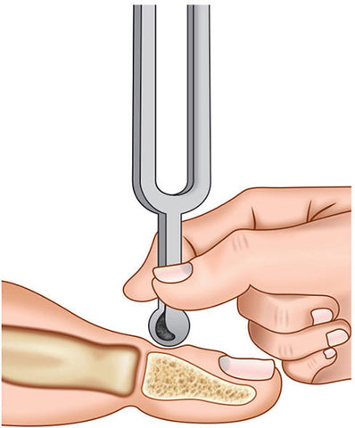 diabetic-foot-tuning-fork