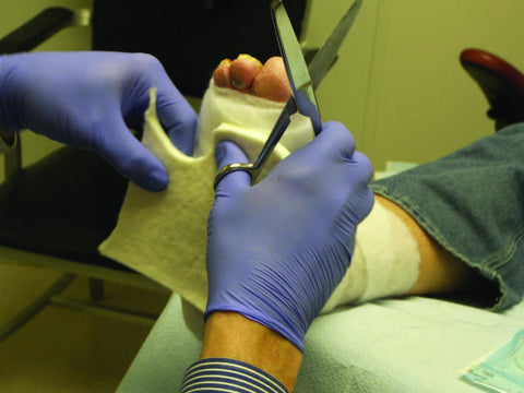 diabetic-foot-wound-care-and-offloading-technique