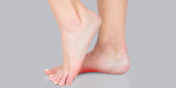 Common Causes Of Arch Pain Cincinnati Foot Ankle Care | art-kk.com