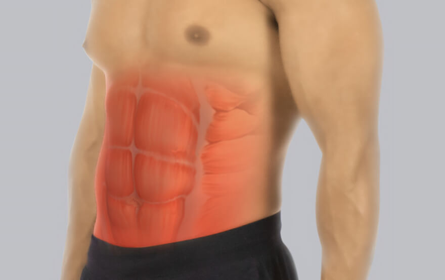 Abdominal Muscle Strain - Identifying the Pain - Vive Health