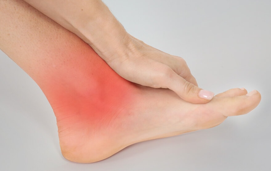 Symptoms and Treatment for a Broken Ankle
