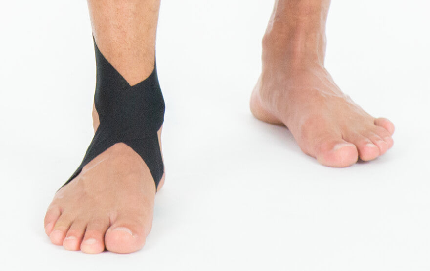Ankle Brace vs. Ankle Tape: Which is Best? – Doc Ortho