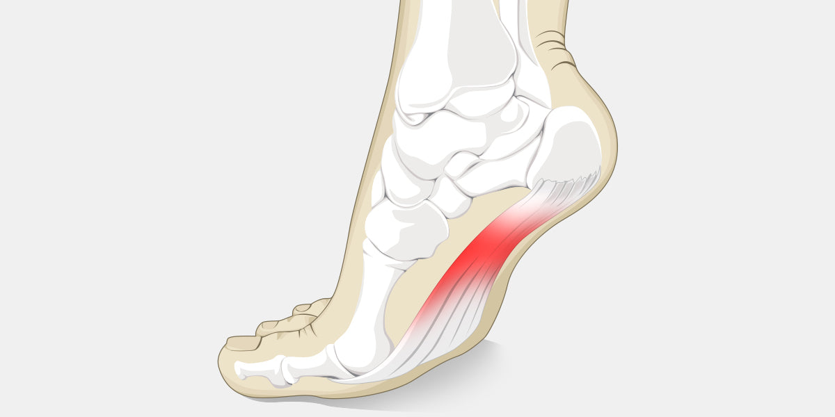 stabbing pain in arch of foot