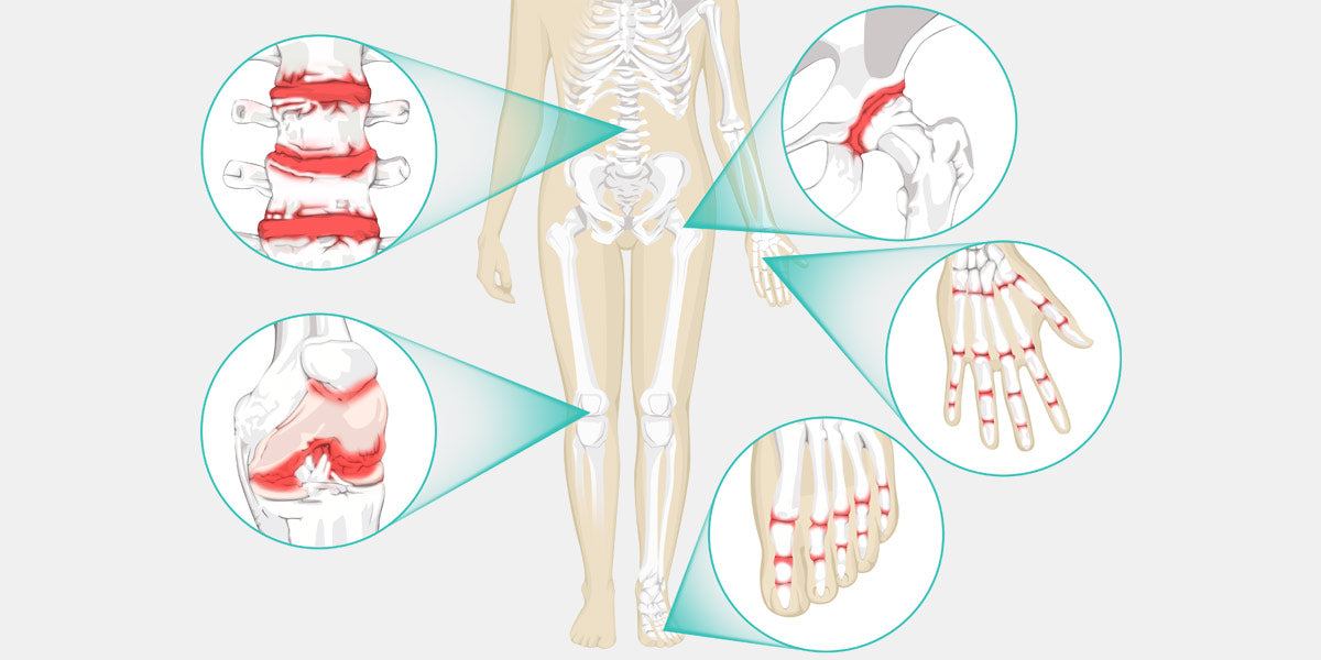 How to Deal with Knee Pain When Sleeping - Vive Health