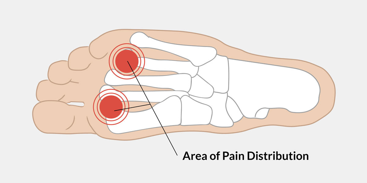 pain in ball of foot