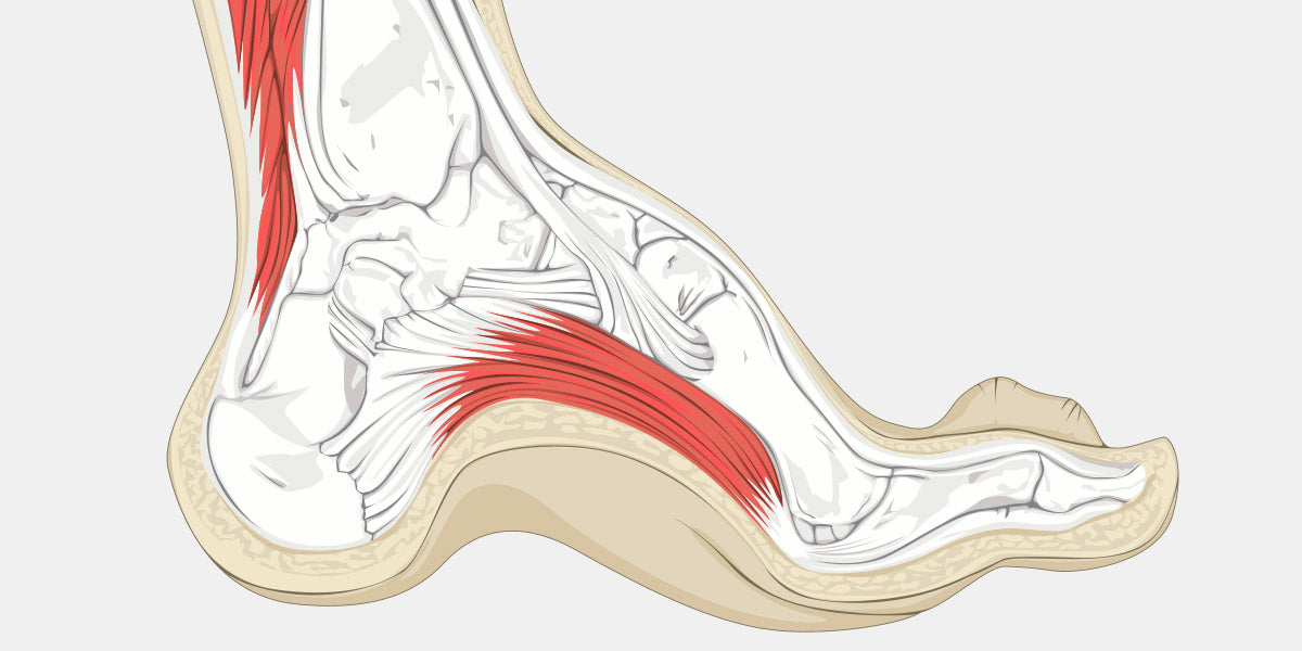 cavus foot