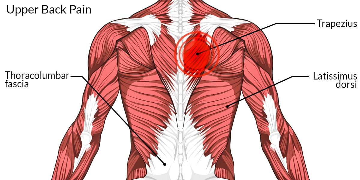 Back Muscles Diagram Pain