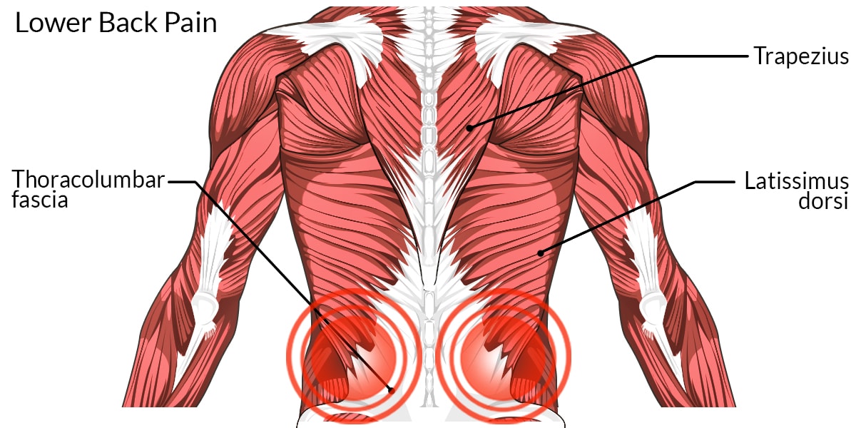 Lower Back Pain - The Complete Injury Guide - Vive Health