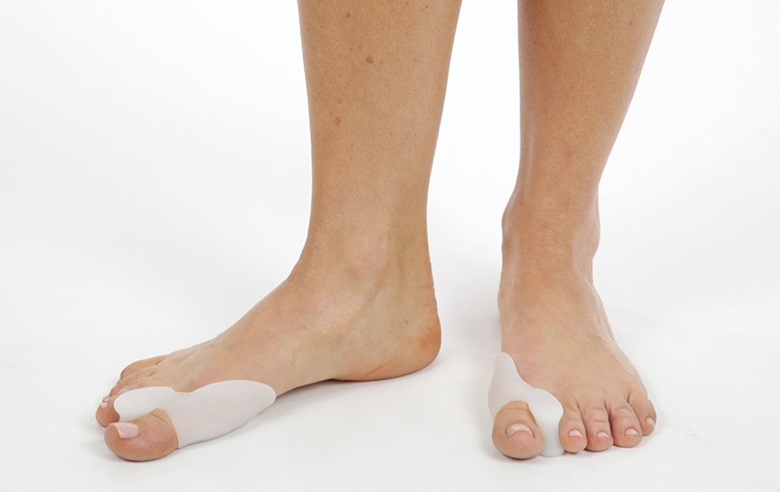 Foot Bunion Protector