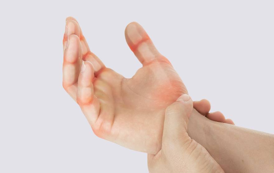 Hand Arthritis