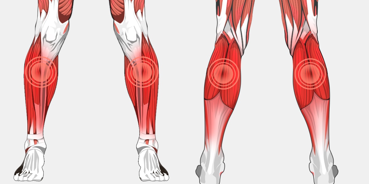 Lower Leg Pain - The Complete Injury Guide - Vive Health