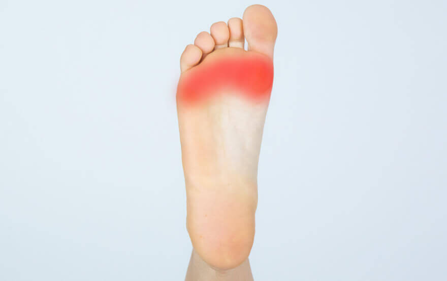 What Triggers Morton's Neuroma? - AOA Orthopedic Specialists