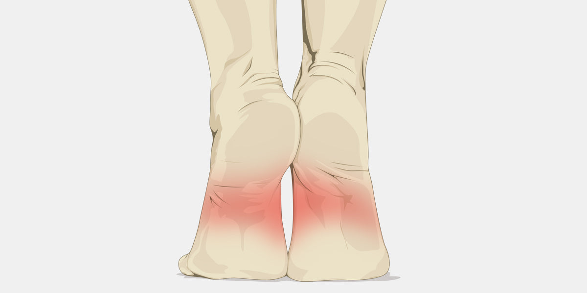 inner foot arch pain