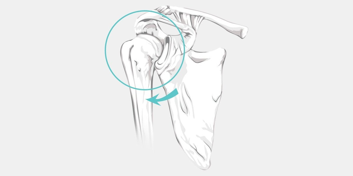 Posterior Shoulder Instability Illustration