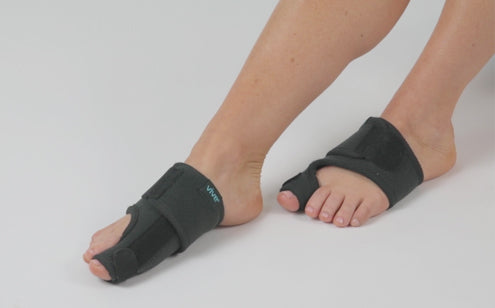 Feet with bunion splint