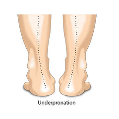 underpronation