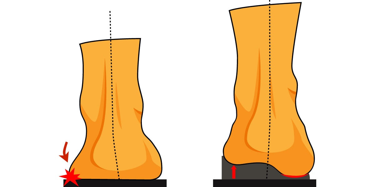 a foot without and with an orthotic