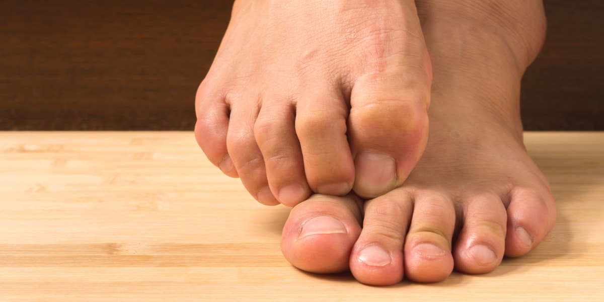 overlapping-toes-the-complete-guide-vive-health