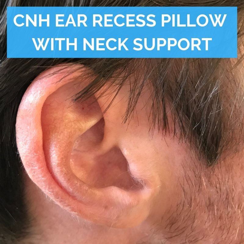 Chondrodermatitis Nodularis Chronica Helicis Cnh Ear Recess Pillow W Putnams