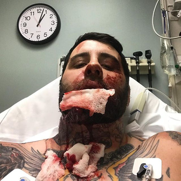 Burger from Mercenary following the motorcycle accident