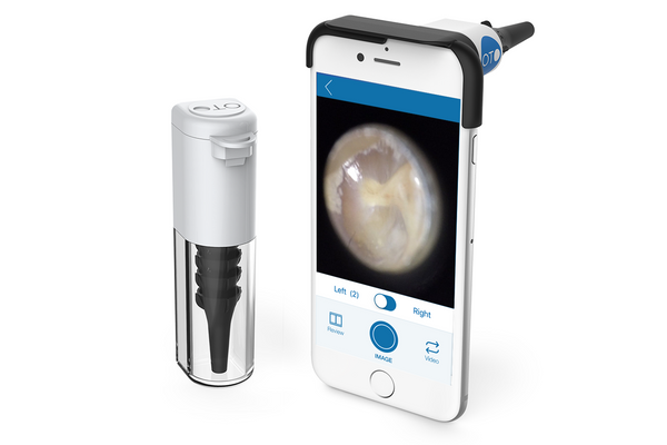Iphone Otoscope Iphone Otoscope