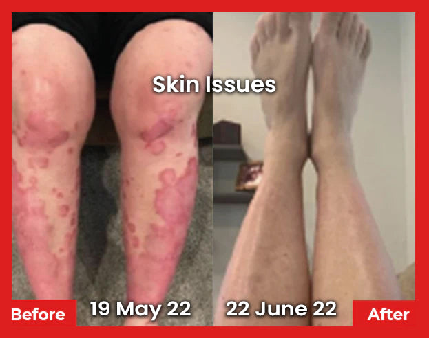Skin Disease Image