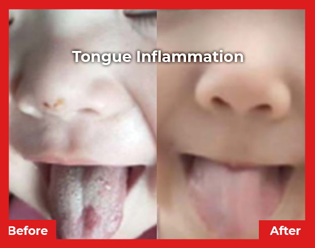 Tongue Image