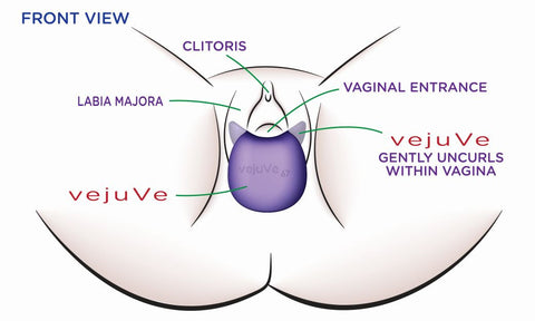 front-view-of-vejuve-enhancer-inside-vagina