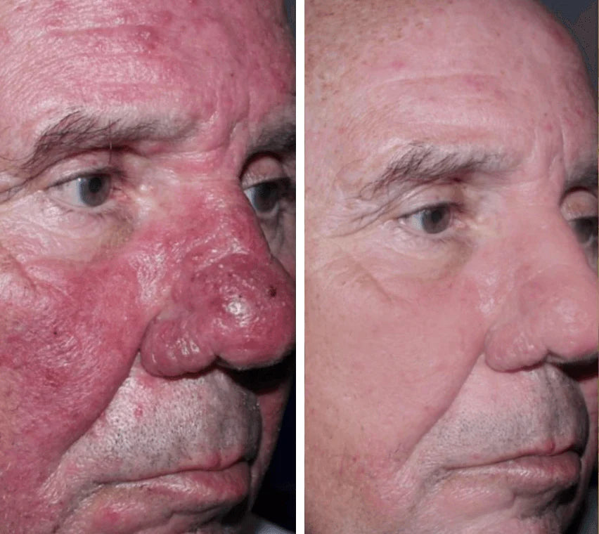 Before and after transformation — steve