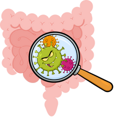 Grafik des Darms mit Bakterienbefall