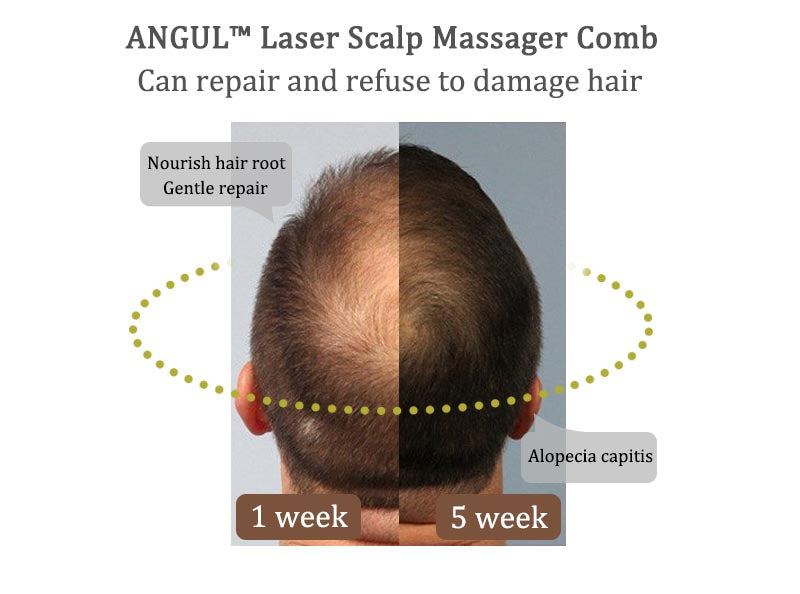 ANGUL™ Laser Scalp Massager Comb