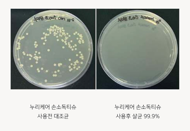 손소독티슈 사용 전후 살균력 테스트