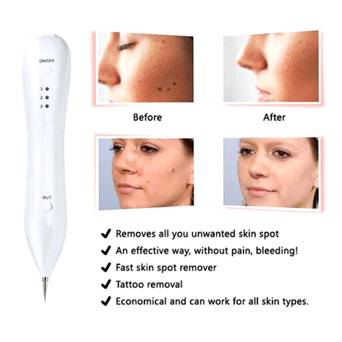 Oveallgo™ PlasmaBeam Facial Beauty Pen