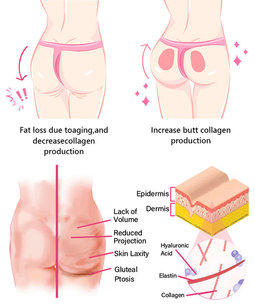 Furzero™ Bottom Enhancement Lift & Shape Posterior Cream