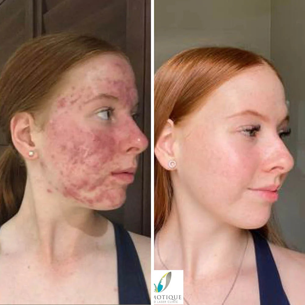 All_Before_and_Afters.webp__PID:e9688505-26c0-4320-a90d-c433e8cd4373
