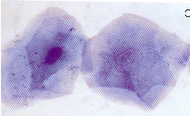 Figure 4. Keratinized vaginal epithelial cells in estrus