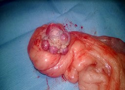 Figure 5. Corpora lutea in the dog ovary