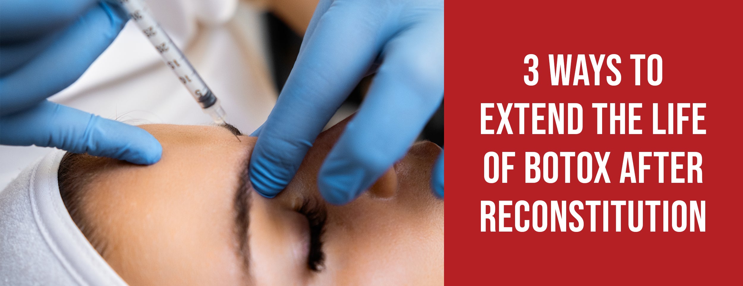 3 Ways to Extend Botox's Life after Reconstitution