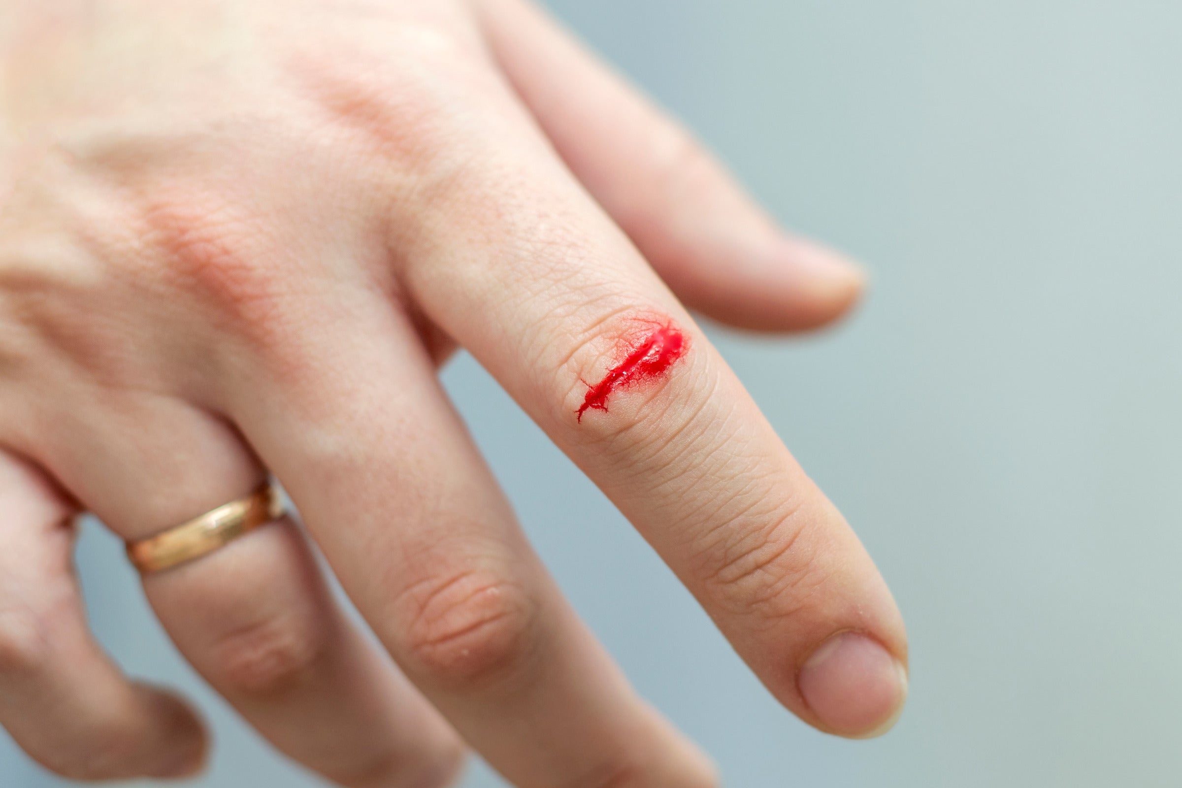 The 5 Risks of Improperly Cleaning Stab Wounds
