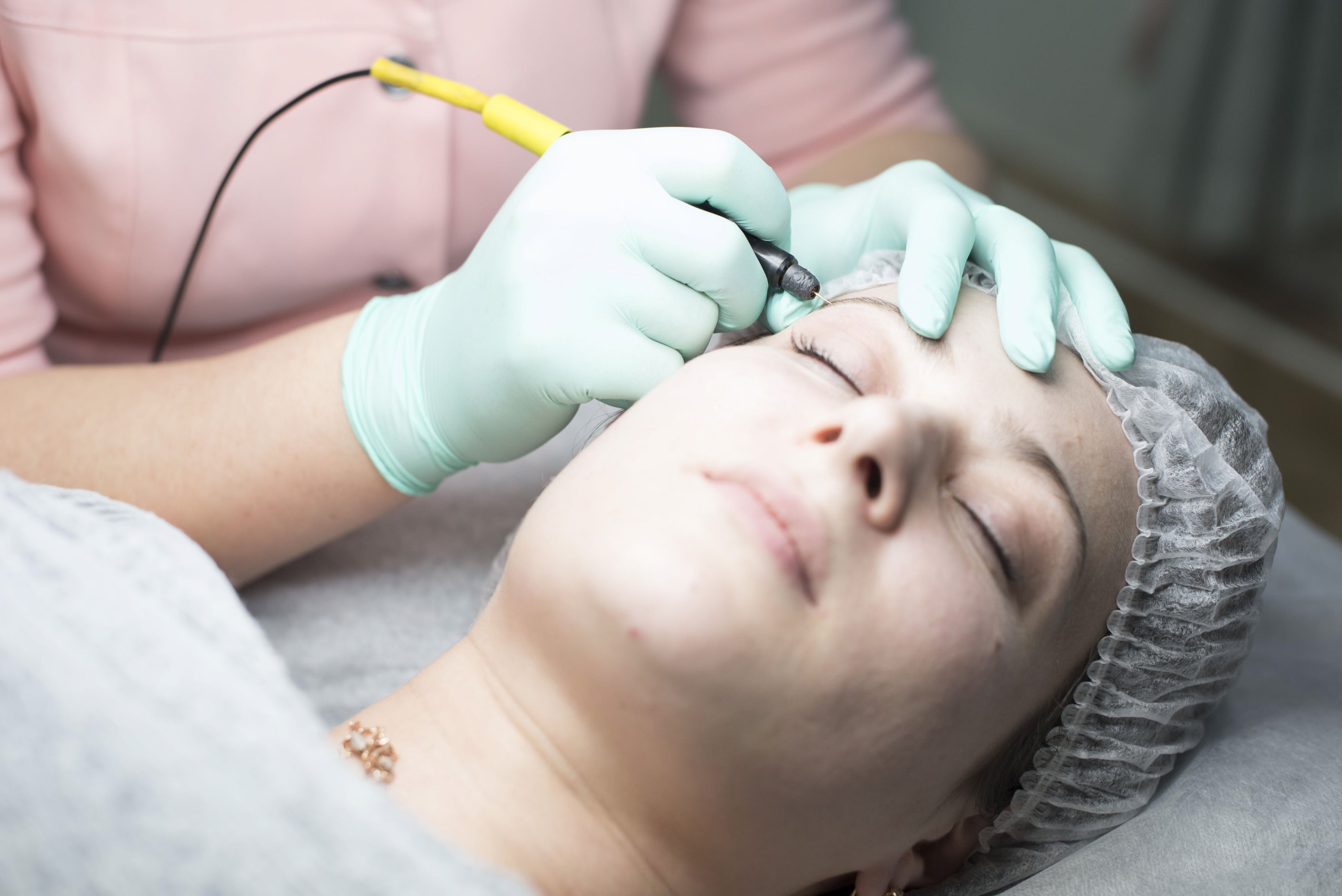 The factors that affect how many electrolysis sessions you need