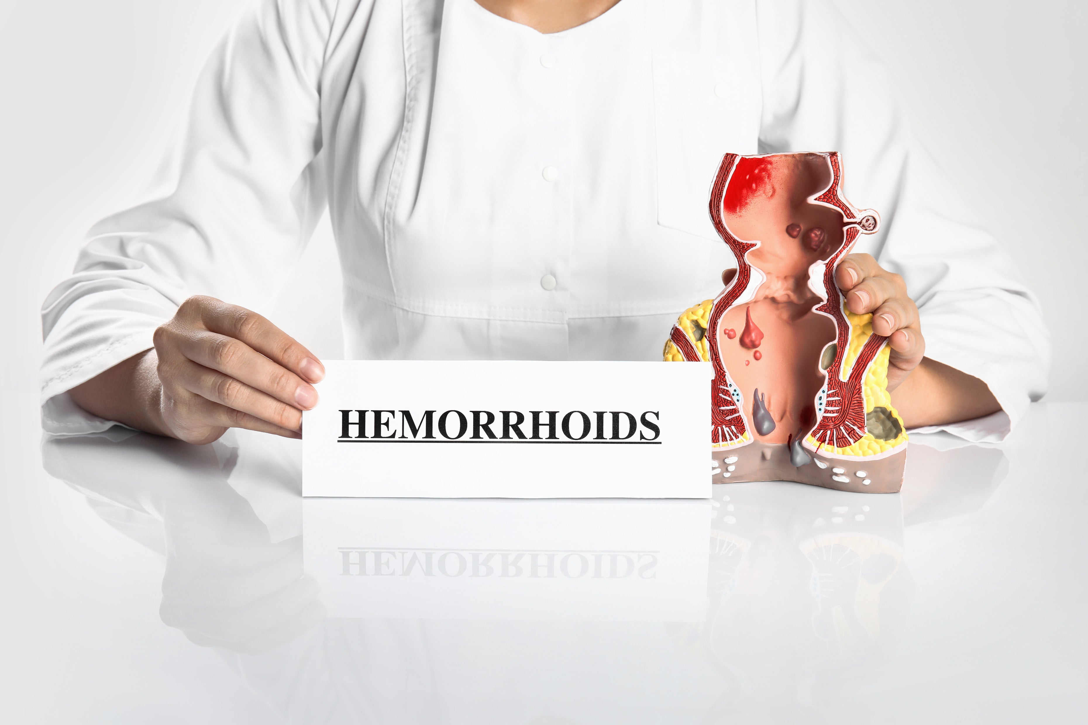 Hemorrhoid cream alternatives and advantages over-the-counter remedies