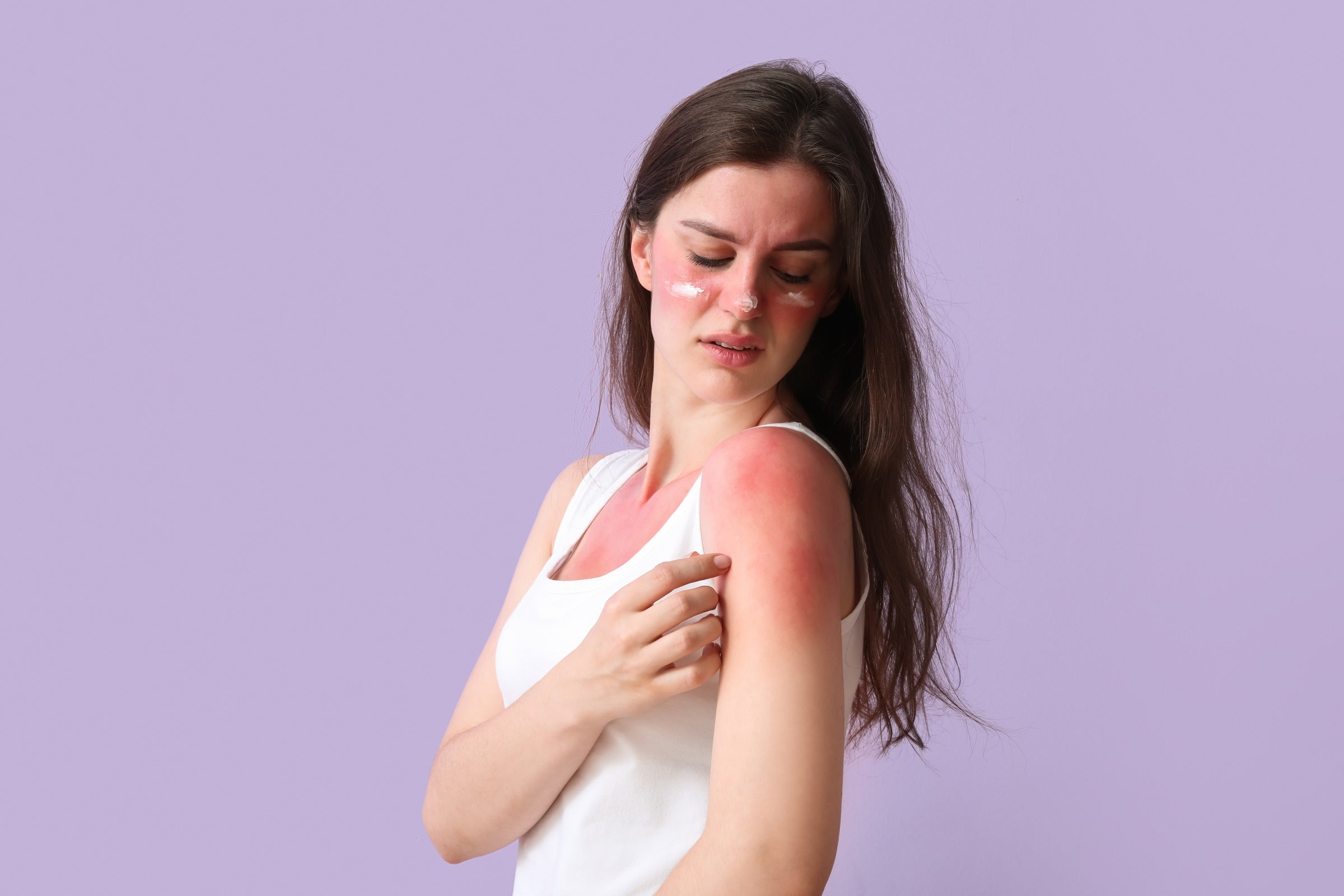 The location of allergies and burning skin