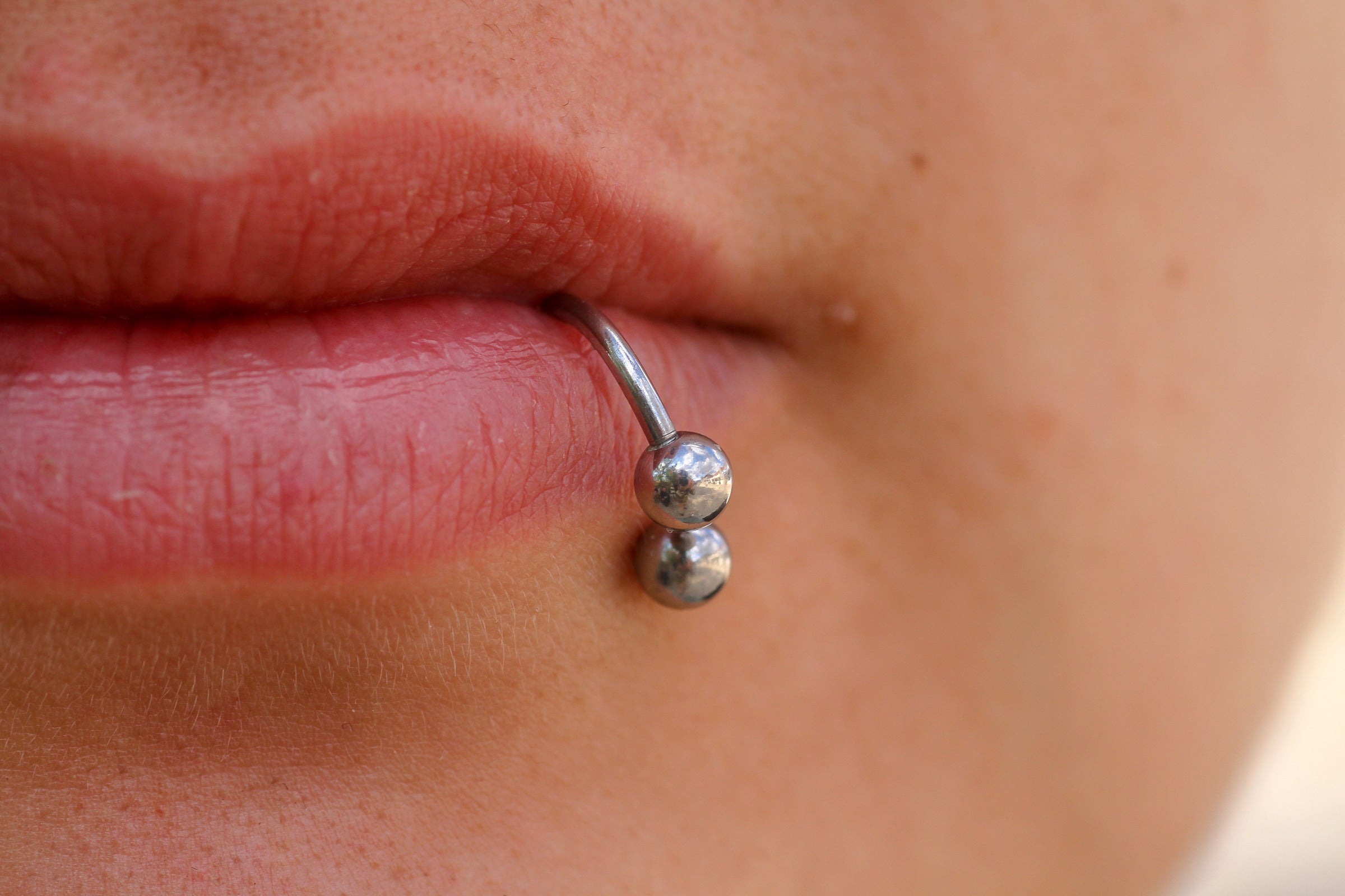 The risks of lip piercing when wearing braces