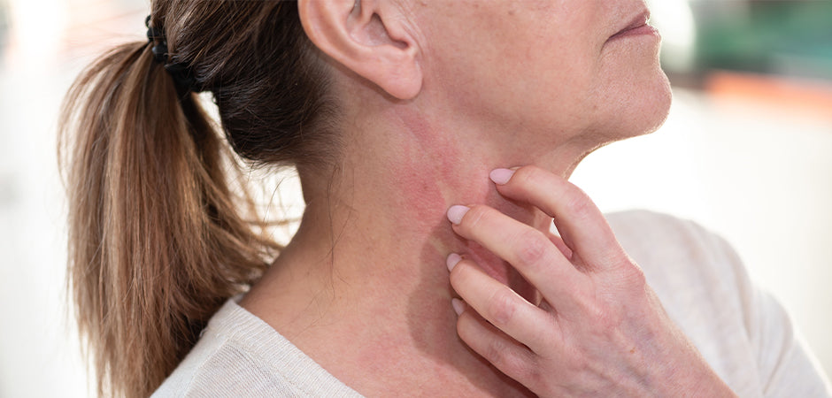 Understanding Menopause Skin Allergies