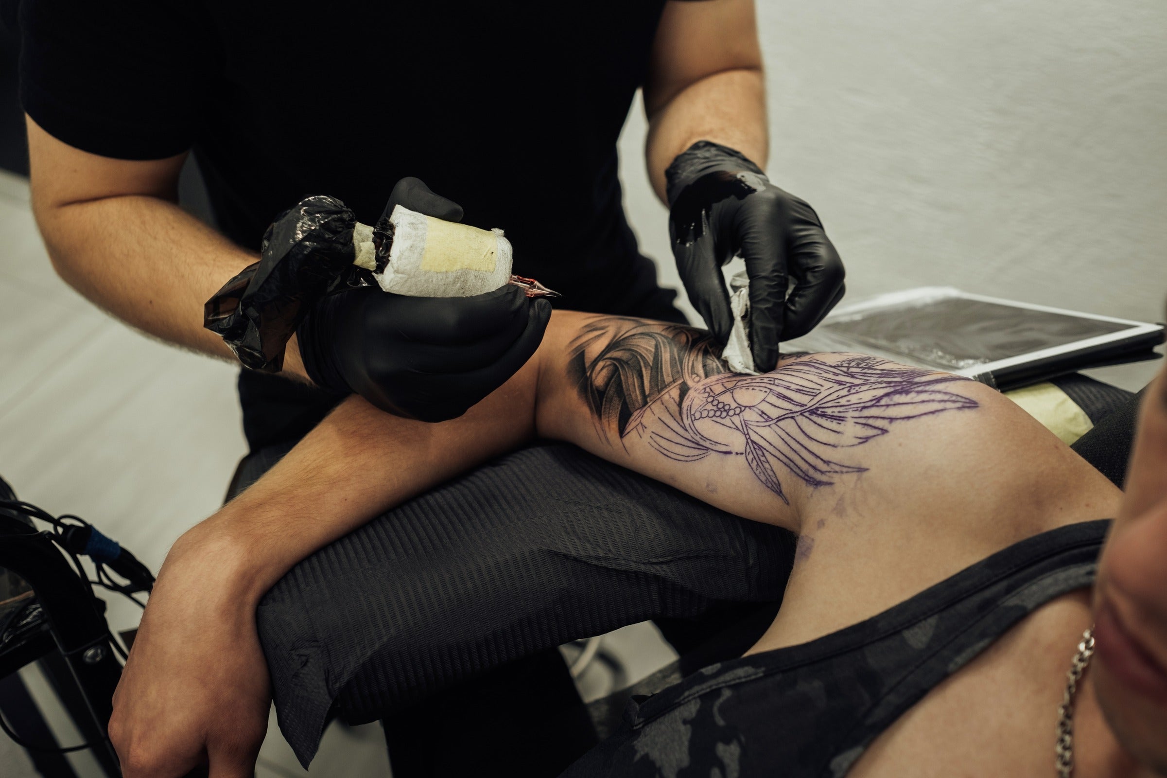7 Factors to Consider Before Lightening a Tattoo