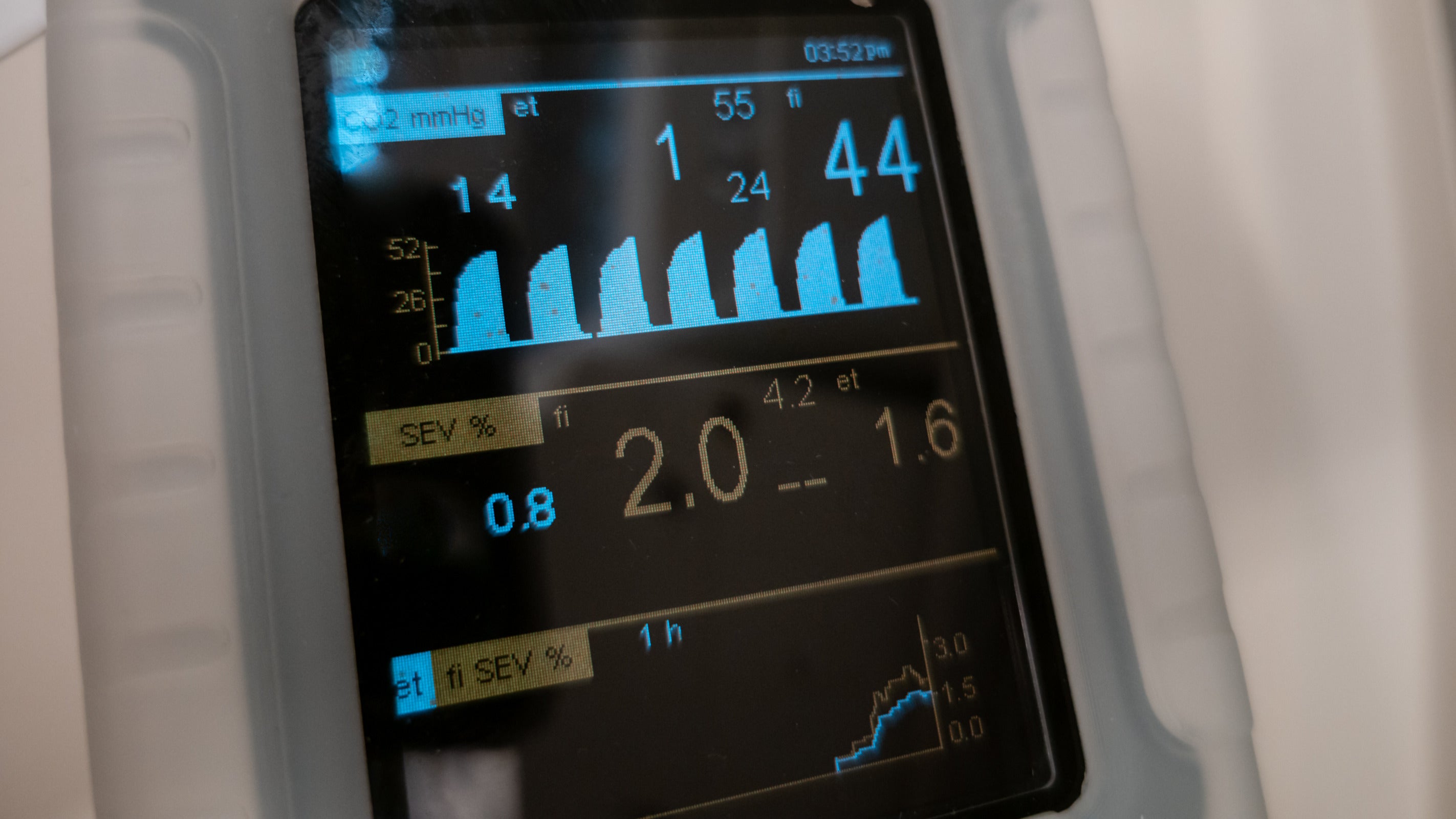 Safety measures and precautions for capnography and monitoring