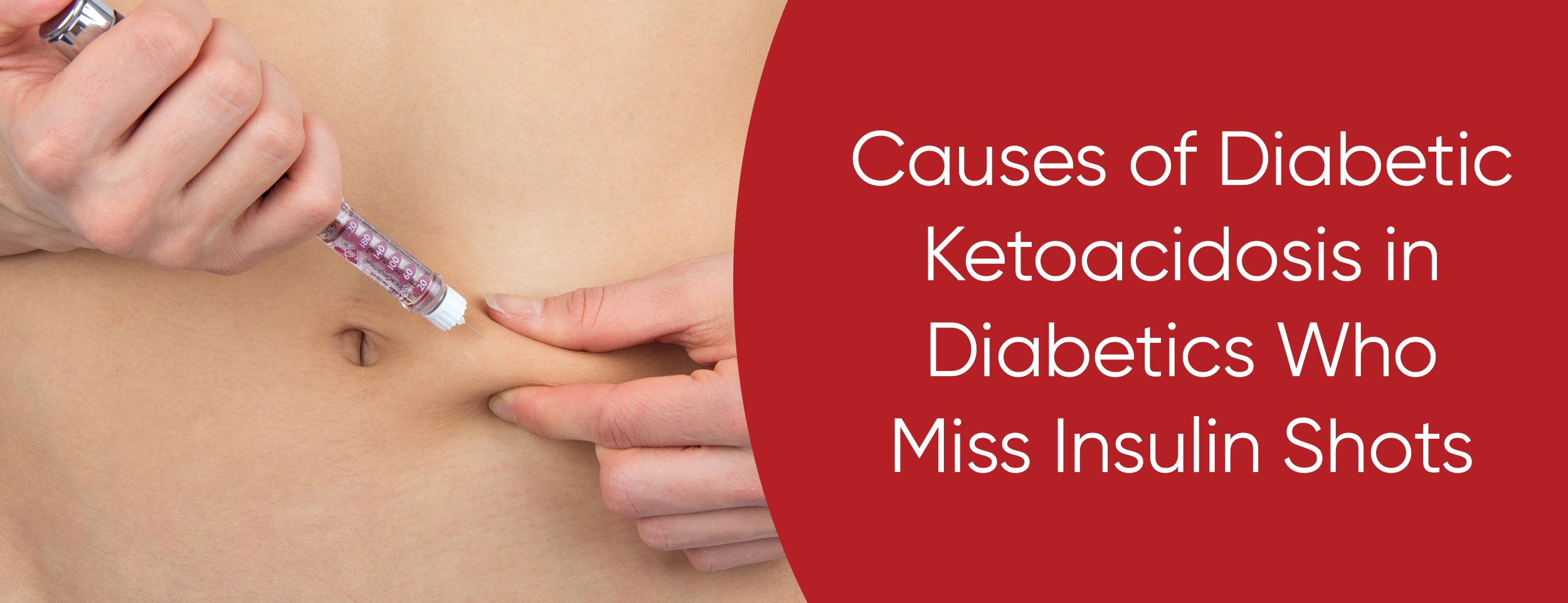 Missed insulin injections in diabetic ketoacidosis
