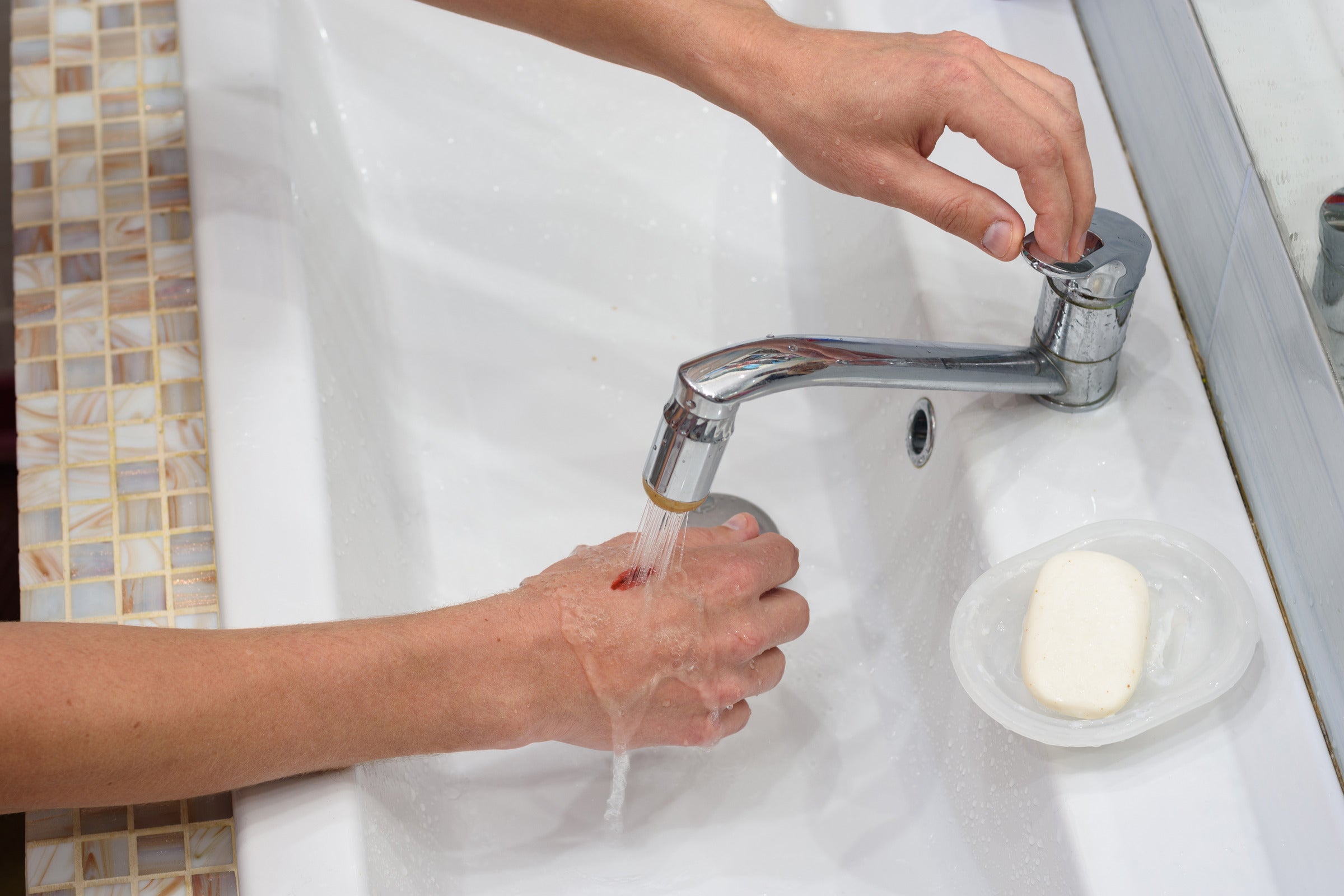 Cool running water and soap are alternatives to disinfectants