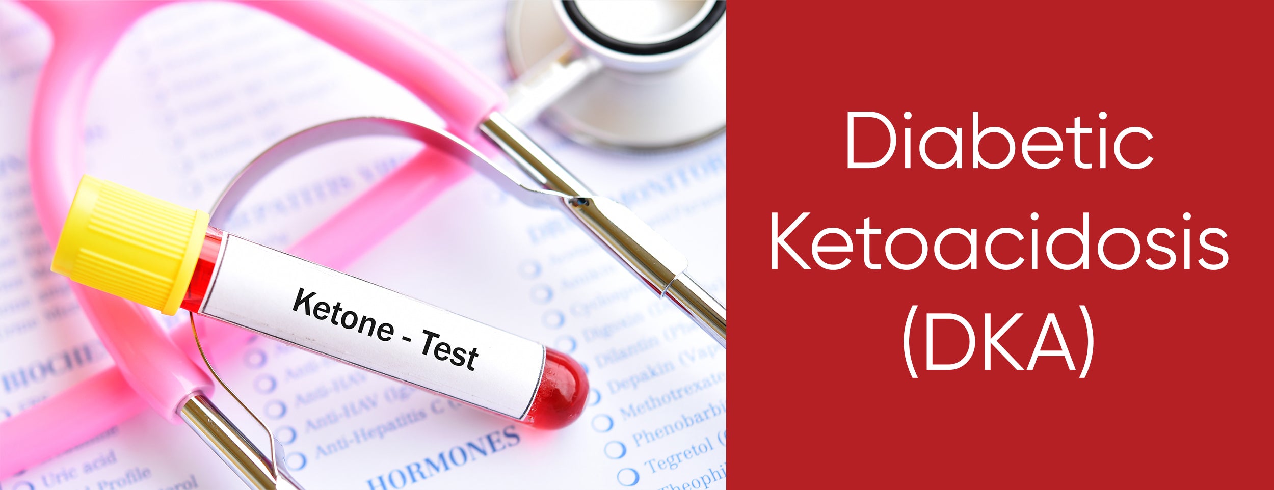 Diabetes Ketoacidosis (DKA) after missing an insulin shot