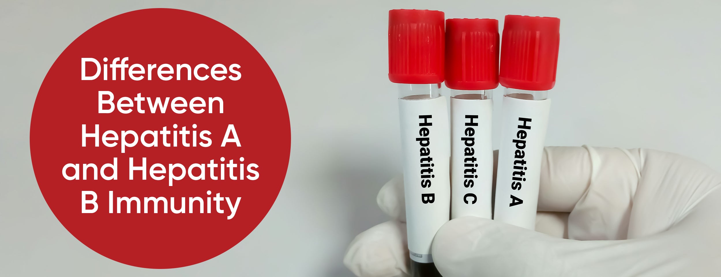 Hepatitis B and A Immunity Differences
